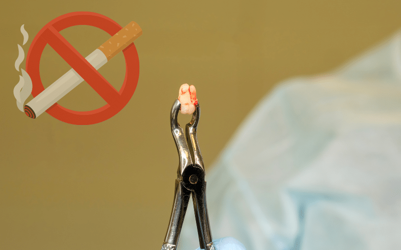 what shouldn't we eat or drink after tooth extraction